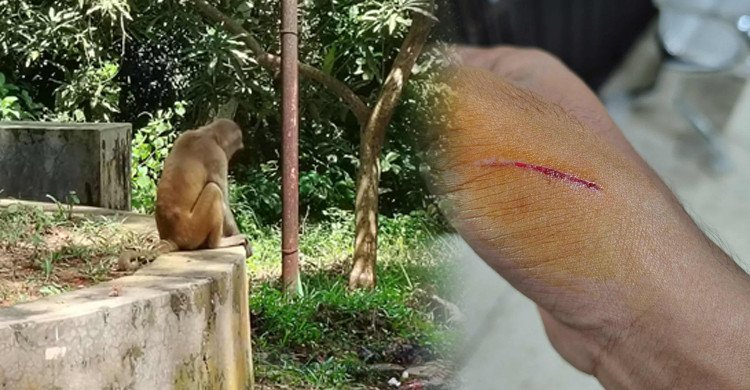 এক বানরে অতিষ্ঠ কুবি, কামড়িয়েছে ১০-১২ জনকে